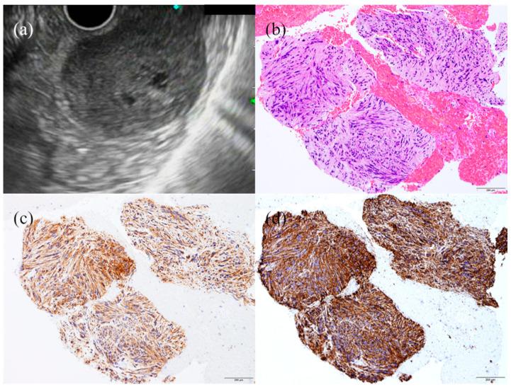 https://cdn.ncbi.nlm.nih.gov/pmc/blobs/6327/7961381/067286756990/jcm-10-01076-g005.jpg