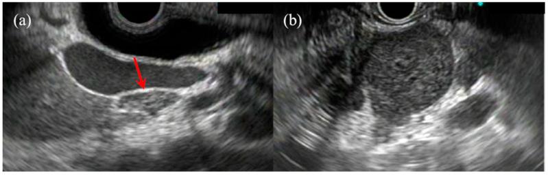https://cdn.ncbi.nlm.nih.gov/pmc/blobs/6327/7961381/5b3546de81ad/jcm-10-01076-g006.jpg