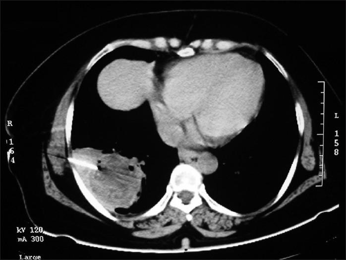 https://cdn.ncbi.nlm.nih.gov/pmc/blobs/6328/2946721/a4e777d9c7cf/LI-27-164-g004.jpg