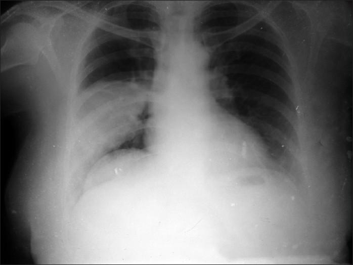 https://cdn.ncbi.nlm.nih.gov/pmc/blobs/6328/2946721/c292f32c2f16/LI-27-164-g001.jpg