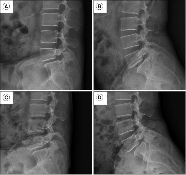 https://cdn.ncbi.nlm.nih.gov/pmc/blobs/6328/6250968/eeaaf4c38831/cios-10-439-g006.jpg