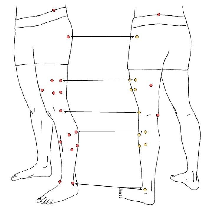 https://cdn.ncbi.nlm.nih.gov/pmc/blobs/632b/11065773/1d6de3403d78/ijspt_2024_19_5_116158_222872.jpg