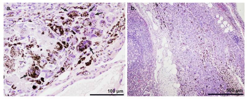 https://cdn.ncbi.nlm.nih.gov/pmc/blobs/6335/11243654/3506d3631770/nanomaterials-14-01149-g006.jpg
