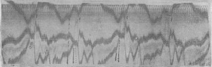 https://cdn.ncbi.nlm.nih.gov/pmc/blobs/6337/1405530/0c999b2d2b74/jphysiol01729-0107-c.jpg