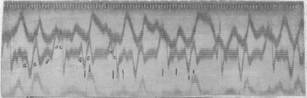 https://cdn.ncbi.nlm.nih.gov/pmc/blobs/6337/1405530/0cc051ab76d5/jphysiol01729-0112-a.jpg