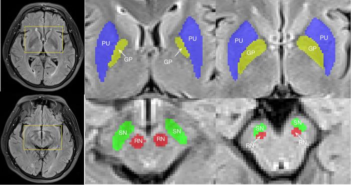 https://cdn.ncbi.nlm.nih.gov/pmc/blobs/6341/12033128/3fc63f276d24/13244_2025_1961_Fig2_HTML.jpg