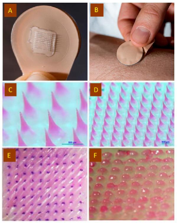 https://cdn.ncbi.nlm.nih.gov/pmc/blobs/6345/9860647/f27984e1ff7b/jfb-14-00016-g003.jpg