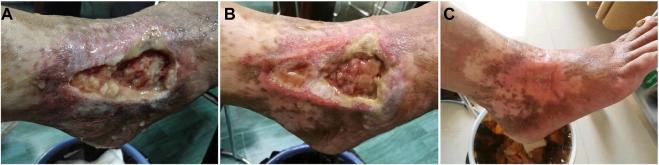 https://cdn.ncbi.nlm.nih.gov/pmc/blobs/634a/8102863/4d70e55a493c/fphar-12-627098-g002.jpg
