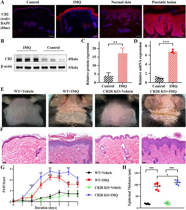 https://cdn.ncbi.nlm.nih.gov/pmc/blobs/634c/8841964/ebe3ab06be21/fphar-13-790712-g001.jpg