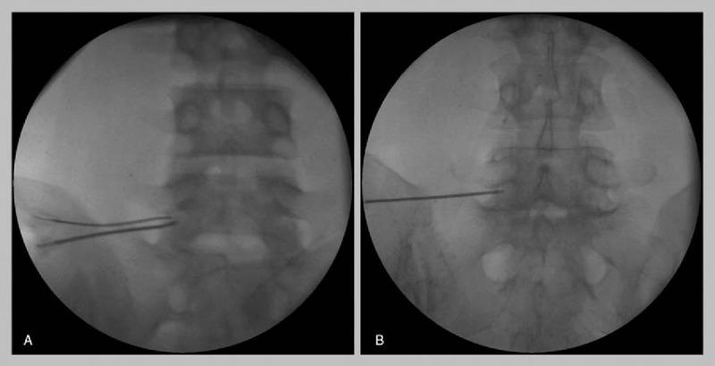 https://cdn.ncbi.nlm.nih.gov/pmc/blobs/6351/5340461/28acddee7247/medi-96-e6236-g002.jpg