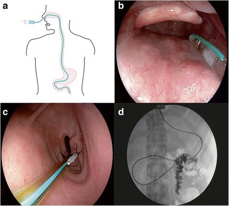 https://cdn.ncbi.nlm.nih.gov/pmc/blobs/6351/5850973/19a02bbaaf4c/12876_2018_766_Fig1_HTML.jpg