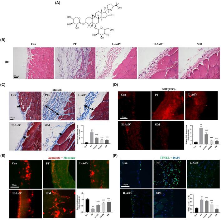 https://cdn.ncbi.nlm.nih.gov/pmc/blobs/6358/10538260/3dd7404adba5/JCMM-27-2945-g005.jpg