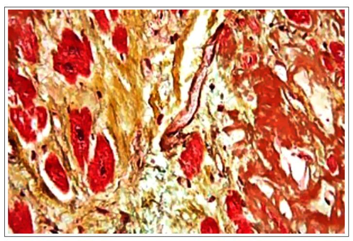 https://cdn.ncbi.nlm.nih.gov/pmc/blobs/6363/11173167/1ec02ca0301d/ijms-25-06176-g001.jpg