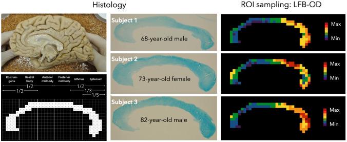 https://cdn.ncbi.nlm.nih.gov/pmc/blobs/636b/9944377/104ae0c4ae5e/429_2022_2600_Fig2_HTML.jpg