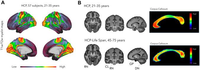 https://cdn.ncbi.nlm.nih.gov/pmc/blobs/636b/9944377/5b1ba15c5f24/429_2022_2600_Fig1_HTML.jpg