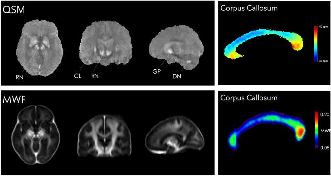 https://cdn.ncbi.nlm.nih.gov/pmc/blobs/636b/9944377/a4e6b6d32997/429_2022_2600_Fig4_HTML.jpg