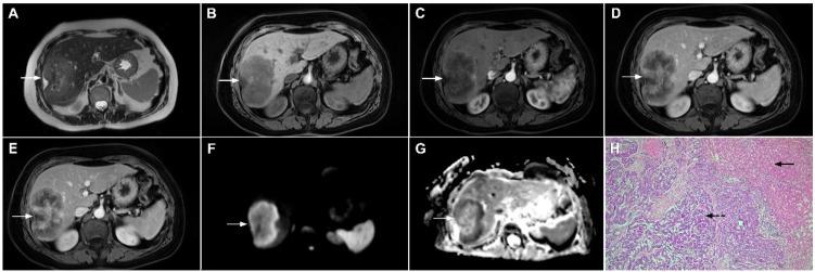 https://cdn.ncbi.nlm.nih.gov/pmc/blobs/636f/8870737/15c8a0eca3ed/curroncol-29-00061-g016.jpg