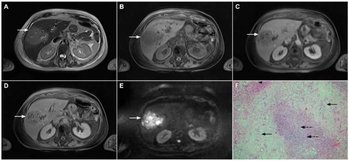 https://cdn.ncbi.nlm.nih.gov/pmc/blobs/636f/8870737/e198722fa4e3/curroncol-29-00061-g013.jpg