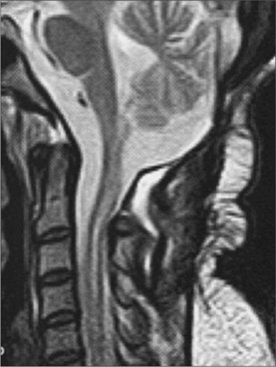 https://cdn.ncbi.nlm.nih.gov/pmc/blobs/6372/9609879/a285213ca37a/SNI-13-448-g003.jpg