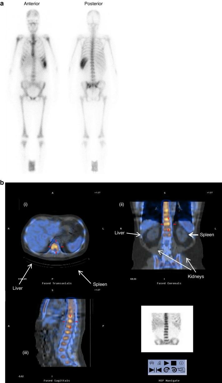 https://cdn.ncbi.nlm.nih.gov/pmc/blobs/6374/11368815/9cc88f801a10/41409_2024_2317_Fig2_HTML.jpg