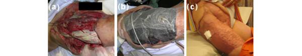 https://cdn.ncbi.nlm.nih.gov/pmc/blobs/637d/1550895/d3098628cad7/cc4868-1.jpg