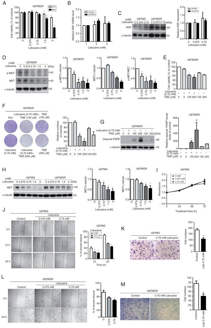 https://cdn.ncbi.nlm.nih.gov/pmc/blobs/637f/11024889/bce1c6233061/or-51-05-08731-g02.jpg