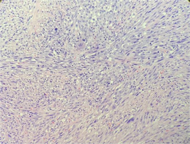 https://cdn.ncbi.nlm.nih.gov/pmc/blobs/6384/10920316/edb1fa58b6b2/CCR3-12-e8612-g003.jpg