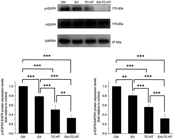 https://cdn.ncbi.nlm.nih.gov/pmc/blobs/638b/11976370/bd83cfc52f90/or-53-05-08891-g02.jpg