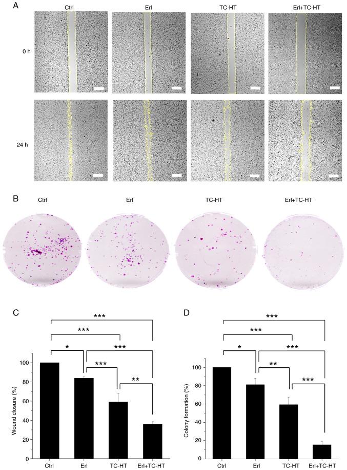 https://cdn.ncbi.nlm.nih.gov/pmc/blobs/638b/11976370/f37c55177ea1/or-53-05-08891-g05.jpg