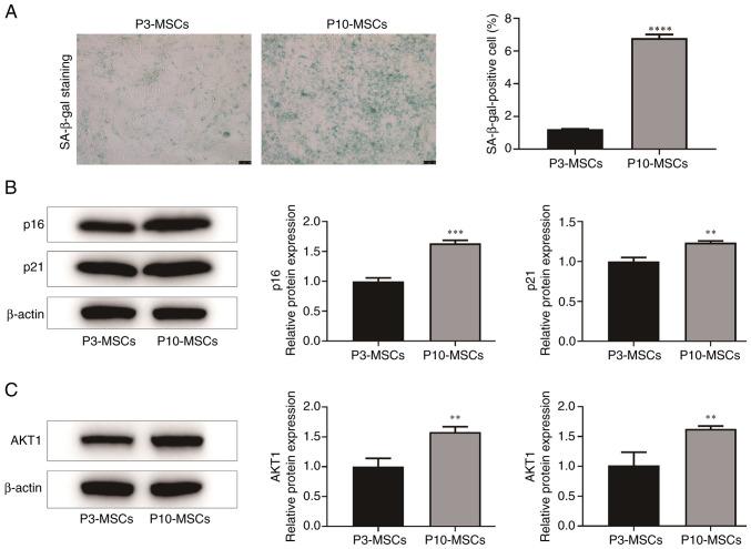 https://cdn.ncbi.nlm.nih.gov/pmc/blobs/638c/12332474/c1e0ce682330/mmr-32-04-13642-g02.jpg