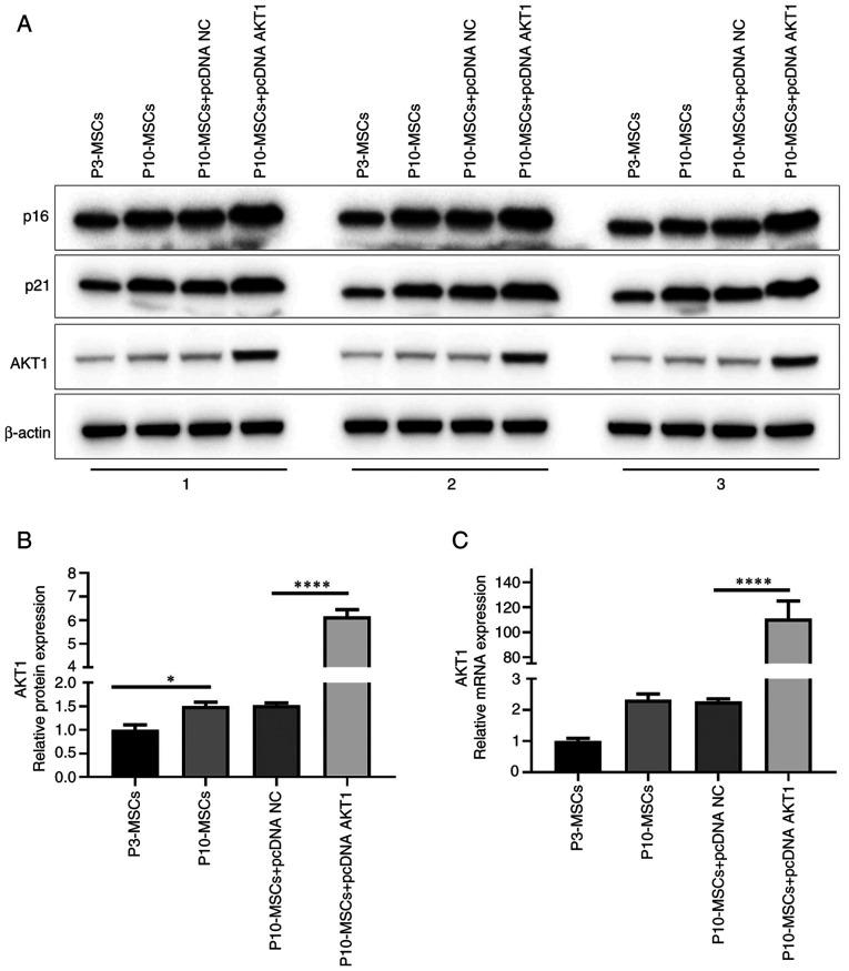 https://cdn.ncbi.nlm.nih.gov/pmc/blobs/638c/12332474/e312feeca8e4/mmr-32-04-13642-g03.jpg