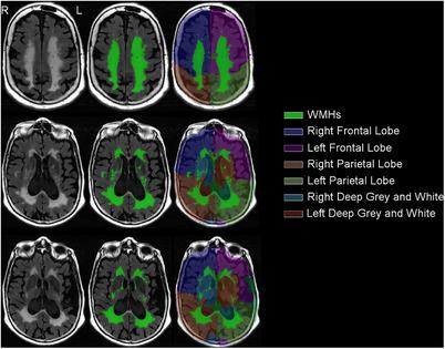 https://cdn.ncbi.nlm.nih.gov/pmc/blobs/6396/11851154/56321e37fbfa/ALZ-21-alz14516-g002.jpg