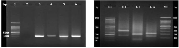 https://cdn.ncbi.nlm.nih.gov/pmc/blobs/6399/6974865/00a59e481854/IJPH-48-2285-g002.jpg