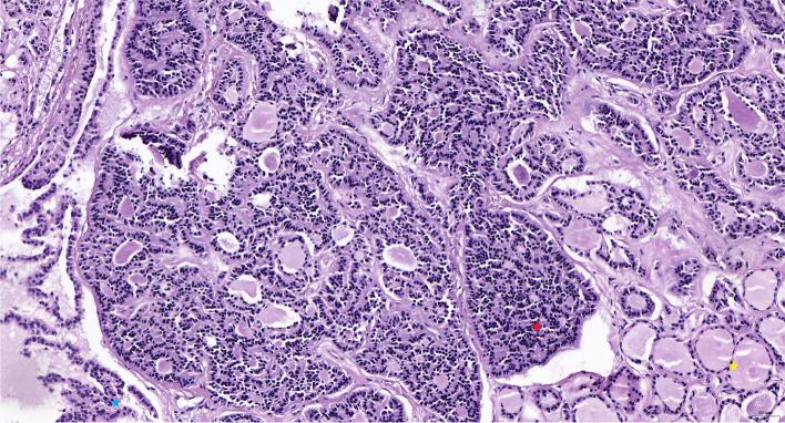 https://cdn.ncbi.nlm.nih.gov/pmc/blobs/6399/9594919/60a1eda4e485/12885_2022_10167_Fig1_HTML.jpg