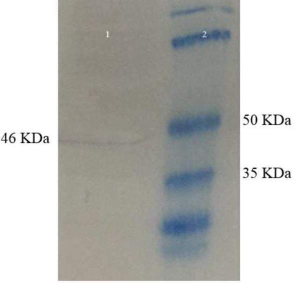 https://cdn.ncbi.nlm.nih.gov/pmc/blobs/639a/7043880/1c79466cc080/IJBMS-22-1493-g004.jpg