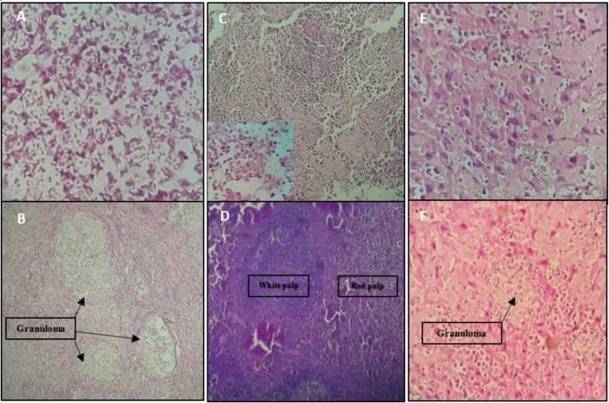 https://cdn.ncbi.nlm.nih.gov/pmc/blobs/639a/7043880/3bdda007071a/IJBMS-22-1493-g008.jpg