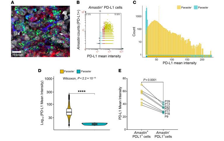 https://cdn.ncbi.nlm.nih.gov/pmc/blobs/639b/8592550/61ced8edeaea/jci-131-142765-g003.jpg