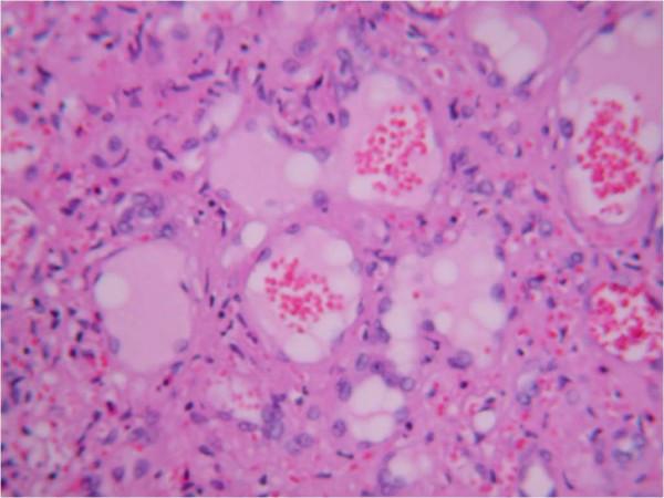 https://cdn.ncbi.nlm.nih.gov/pmc/blobs/639f/2387157/324d72e808cd/1752-1947-2-133-3.jpg