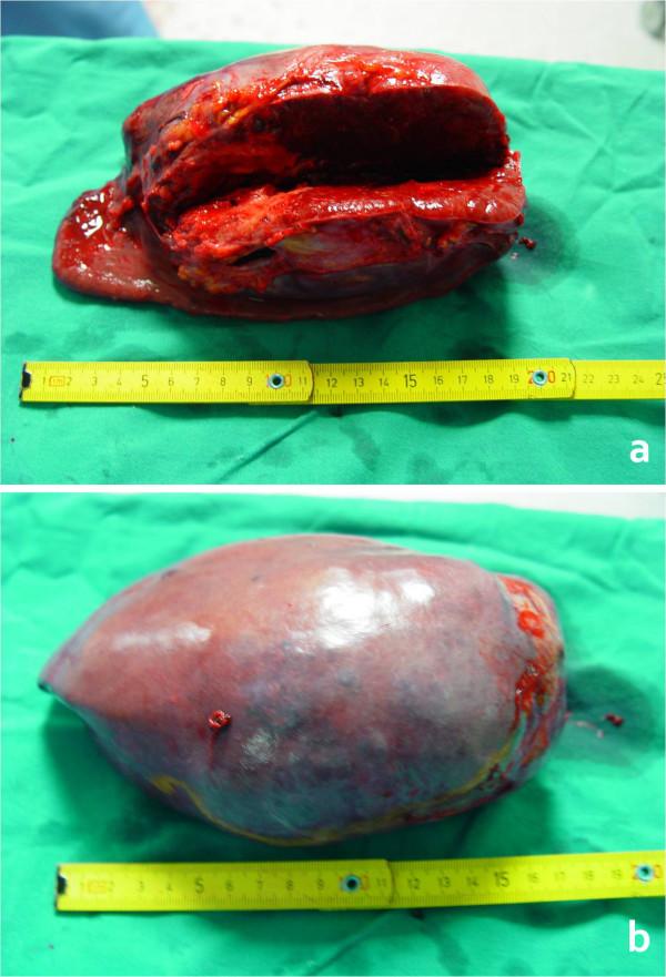 https://cdn.ncbi.nlm.nih.gov/pmc/blobs/639f/2387157/f07580d595a7/1752-1947-2-133-2.jpg