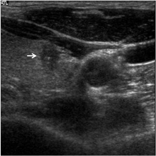 https://cdn.ncbi.nlm.nih.gov/pmc/blobs/63a1/2651443/c4fb1b85bdde/kjr-10-101-g003.jpg