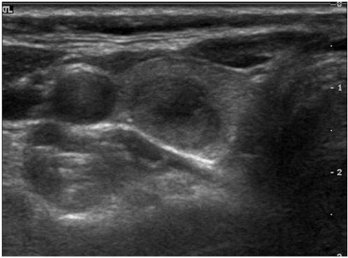https://cdn.ncbi.nlm.nih.gov/pmc/blobs/63a1/2651443/ef6251896c53/kjr-10-101-g002.jpg