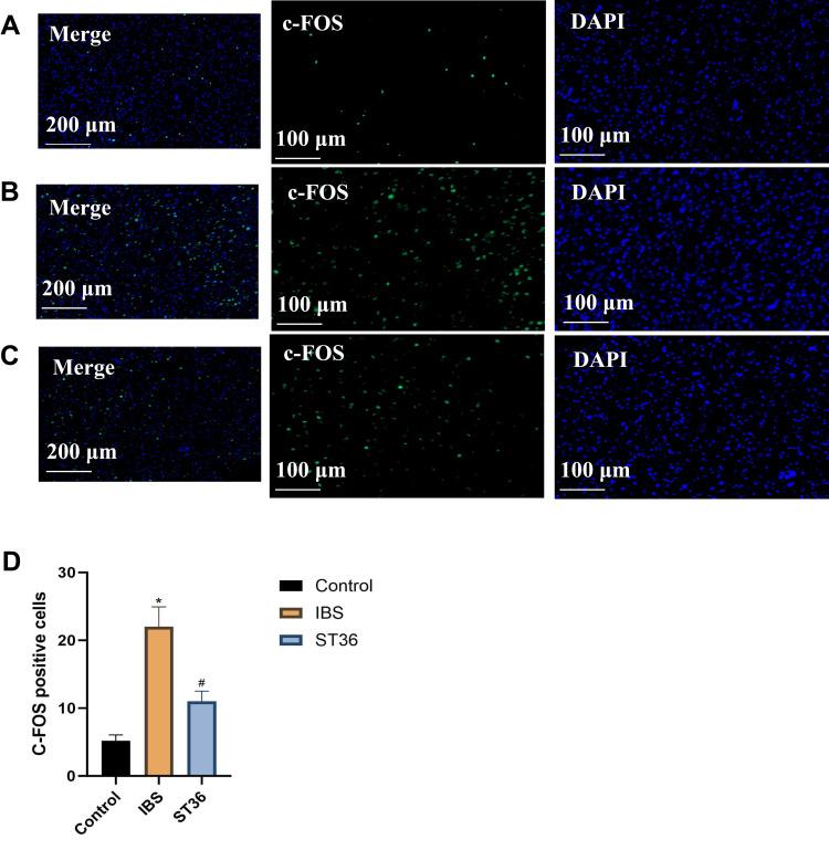 https://cdn.ncbi.nlm.nih.gov/pmc/blobs/63a5/12396234/5939fd520e76/NDT-21-1761-g0007.jpg