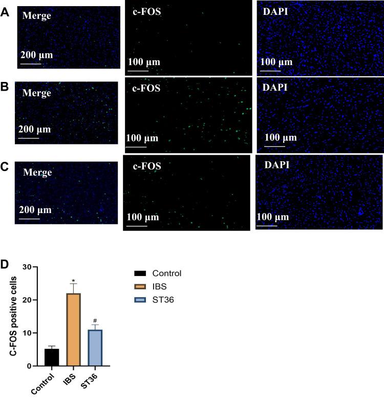 https://cdn.ncbi.nlm.nih.gov/pmc/blobs/63a5/12396234/f2f580259027/NDT-21-1761-g0008.jpg