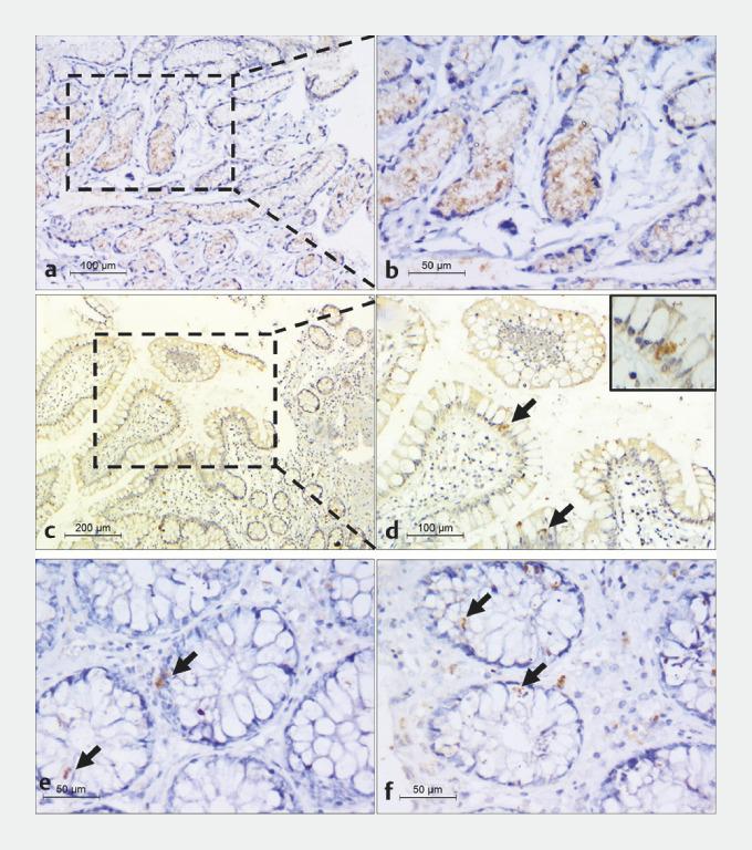 https://cdn.ncbi.nlm.nih.gov/pmc/blobs/63a7/10769582/1e4bf38ff3f8/10-1055-a-2180-9872_21831397.jpg