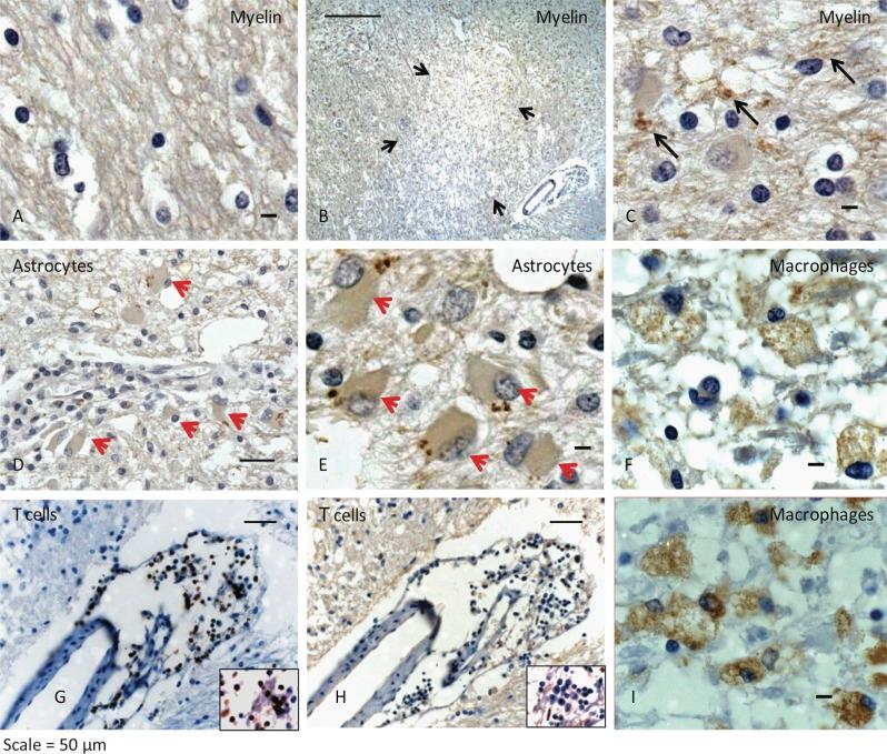 https://cdn.ncbi.nlm.nih.gov/pmc/blobs/63a9/3405500/8f545b1c2f30/JEM_20101974_Fig5.jpg