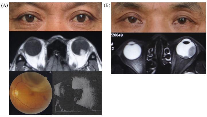 https://cdn.ncbi.nlm.nih.gov/pmc/blobs/63aa/7586035/b943738cb81e/10.1177_1758835920965852-fig1.jpg