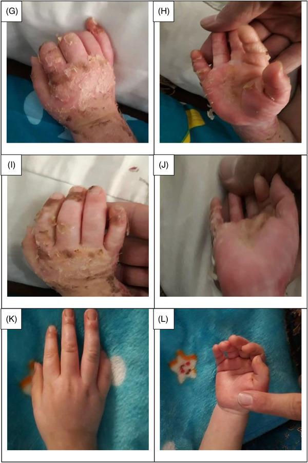 https://cdn.ncbi.nlm.nih.gov/pmc/blobs/63ab/10511837/a736b372b192/SRT-29-e13471-g007.jpg