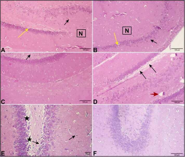 https://cdn.ncbi.nlm.nih.gov/pmc/blobs/63b3/11841213/5408ad2bdef3/gr5.jpg