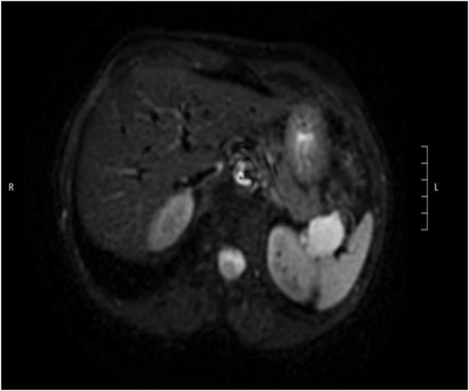 https://cdn.ncbi.nlm.nih.gov/pmc/blobs/63b3/12146039/5ea3eee57390/gr1.jpg