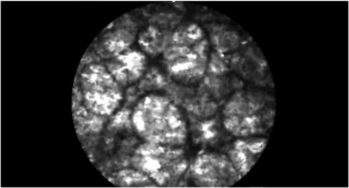https://cdn.ncbi.nlm.nih.gov/pmc/blobs/63b3/12146039/c62ca5ff6ca0/gr3.jpg